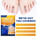 Fungal Nail Patches