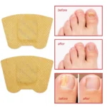 Fungal Nail Patches - 图片 3